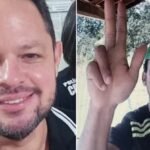 PM morre após ser ferido com corte profundo no braço causado por disco de uma bicicleta